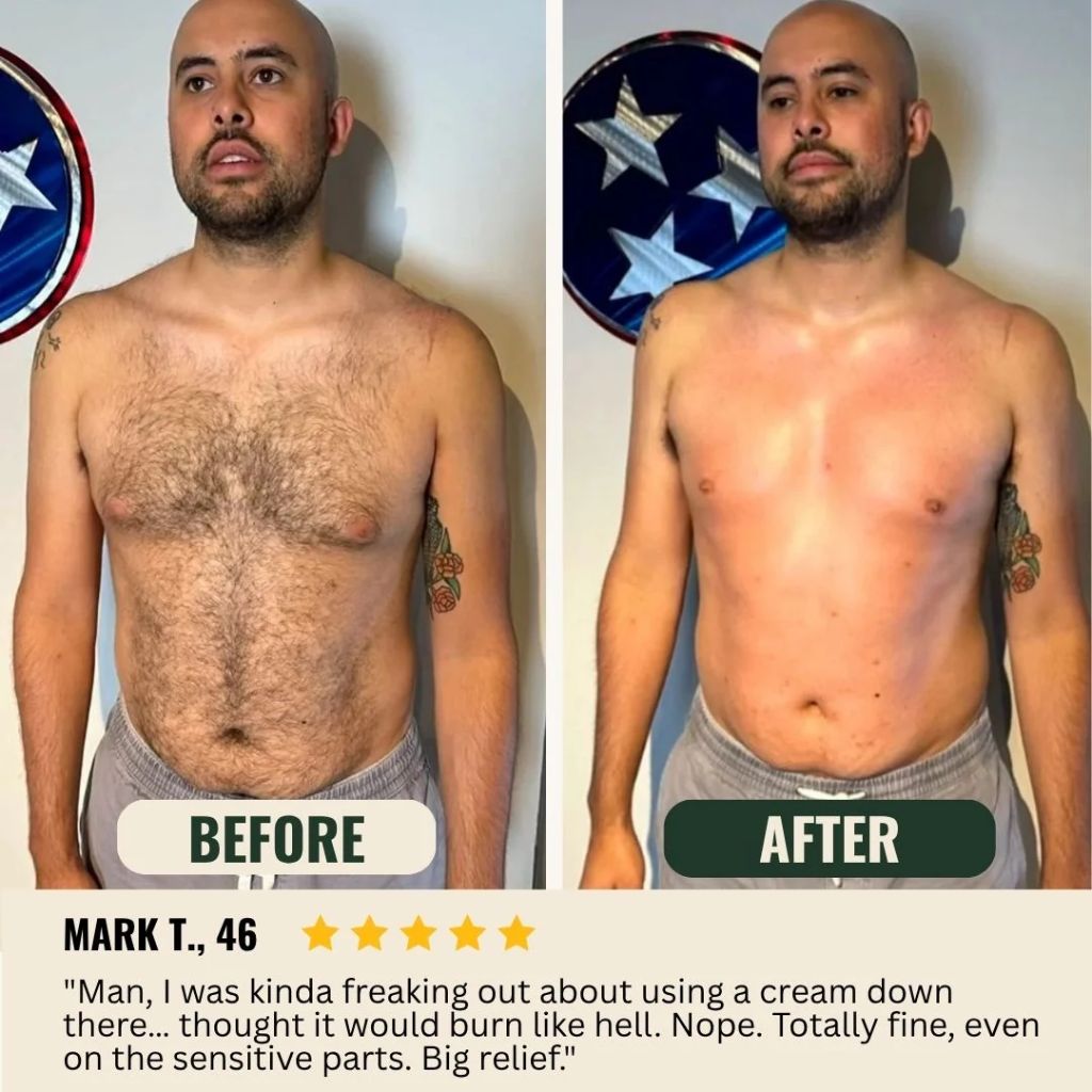 Hair removal