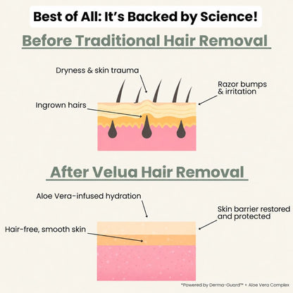 Hair removal