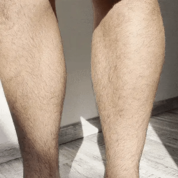 Hair removal