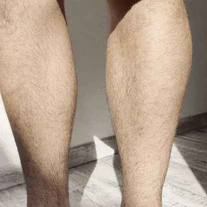 Hair removal